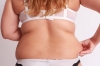Body Lift Surgery - Tummy, Thigh, Breast, Arm Lift Cosmetic Surgery Delhi, India Avatar